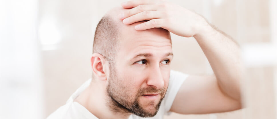 Balding Crown: How to Spot it – and What to Do about It - Health Centre by  Manual | Medical Information, Reviewed by Experts