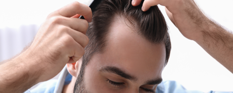 Hair Thinning at the Front? Here are Your Options - Health Centre by Manual  | Medical Information, Reviewed by Experts